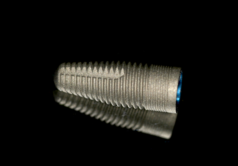 Implants dentaires